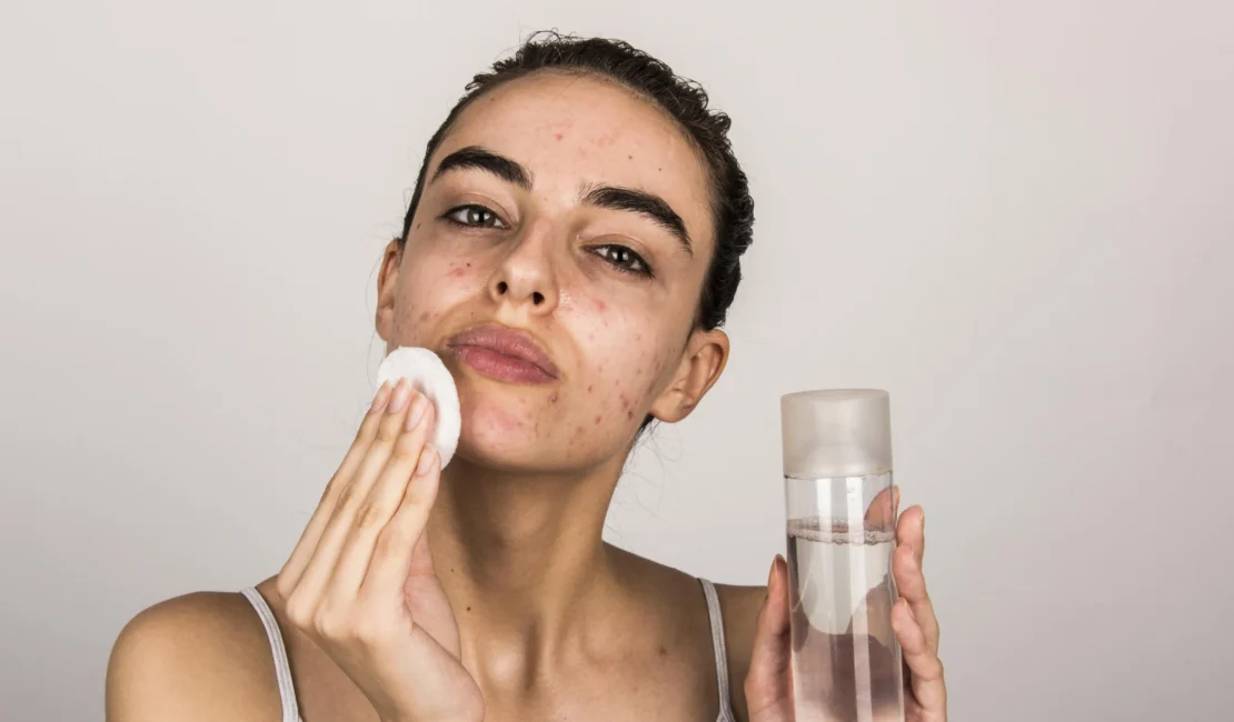 Effective Skincare for Oily Skin