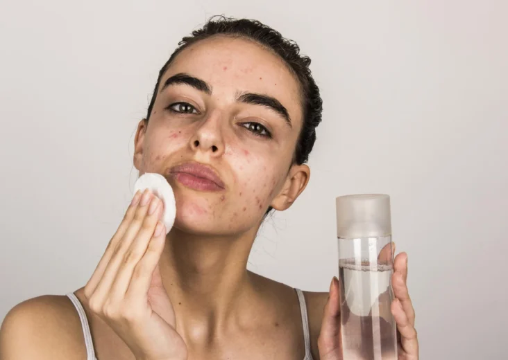 Effective Skincare for Oily Skin