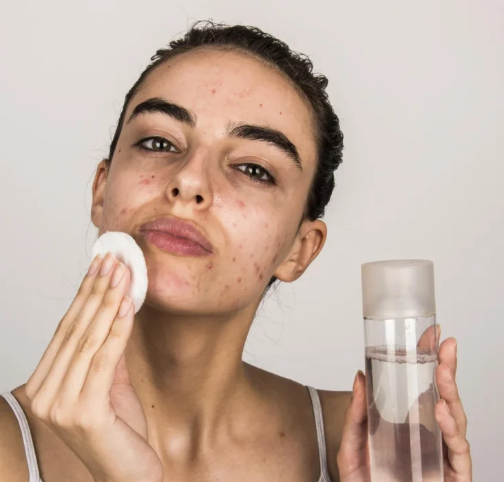 Effective Skincare for Oily Skin