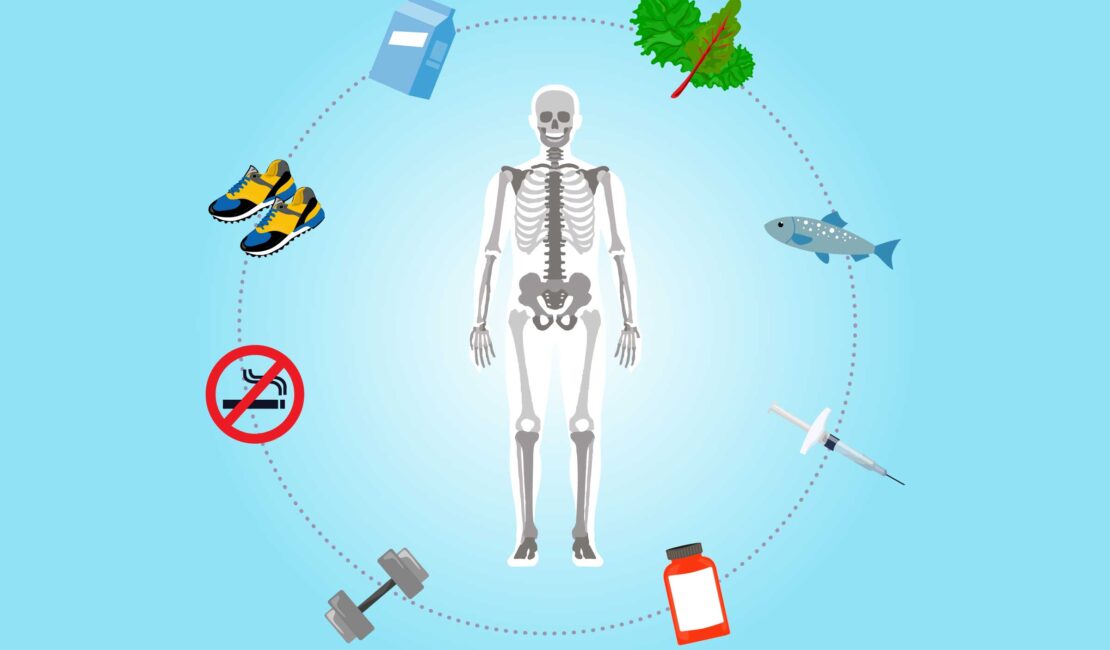 Strategies for Preventing Bone Fractures