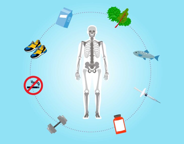 Strategies for Preventing Bone Fractures