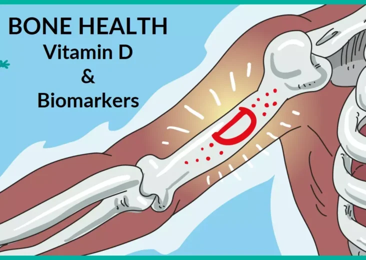 Illuminating Bone Health