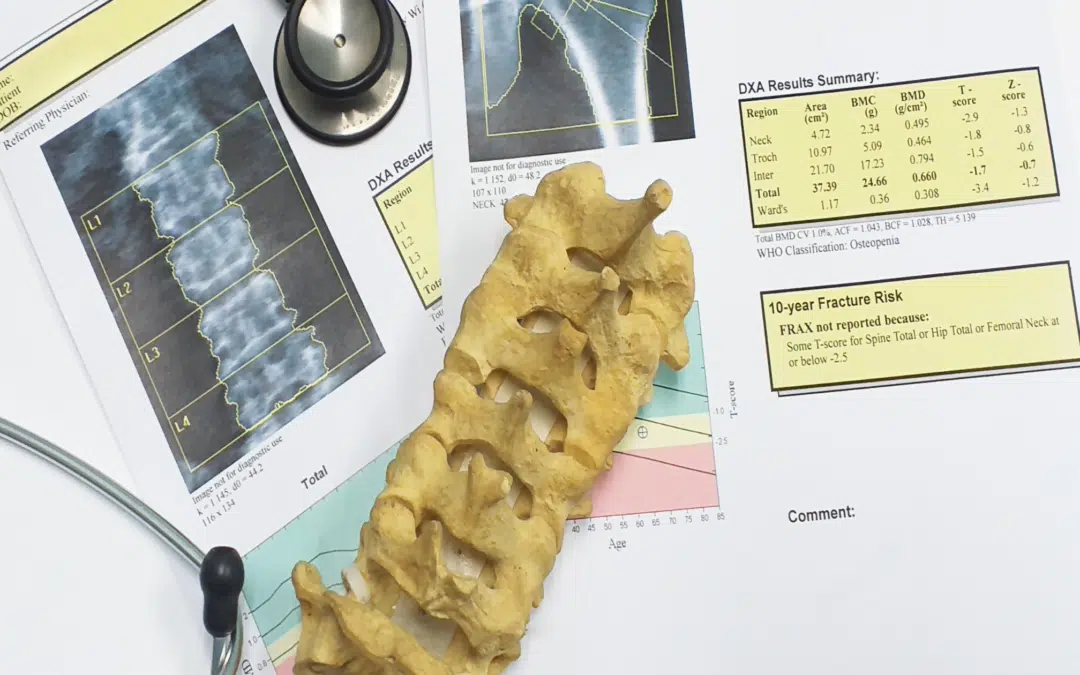 Understanding Peak Bone Mass: Building Strong Foundations for Lifelong Bone Health