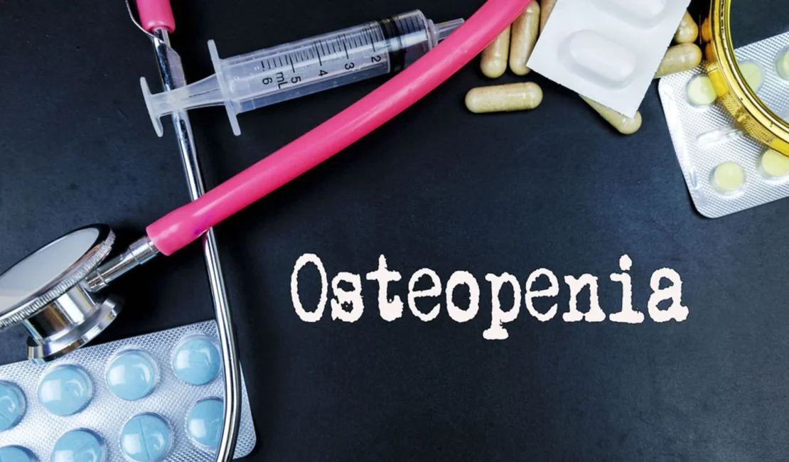 Understanding Osteopenia and Osteoporosis