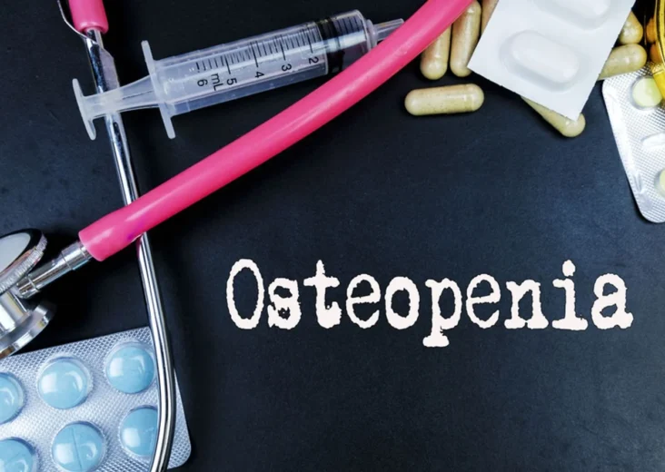 Understanding Osteopenia and Osteoporosis