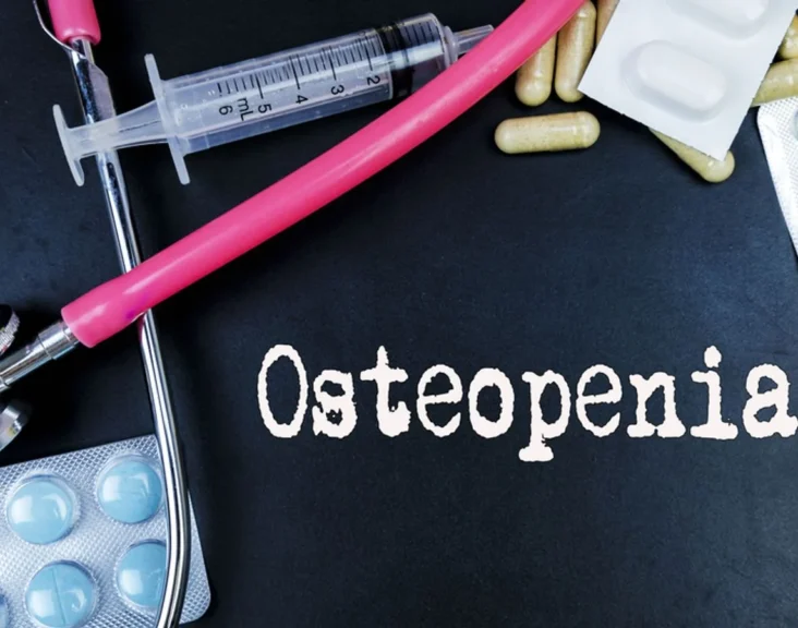 Understanding Osteopenia and Osteoporosis