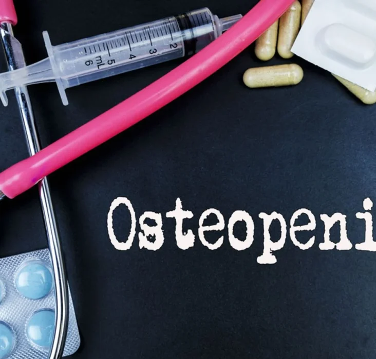 Understanding Osteopenia and Osteoporosis